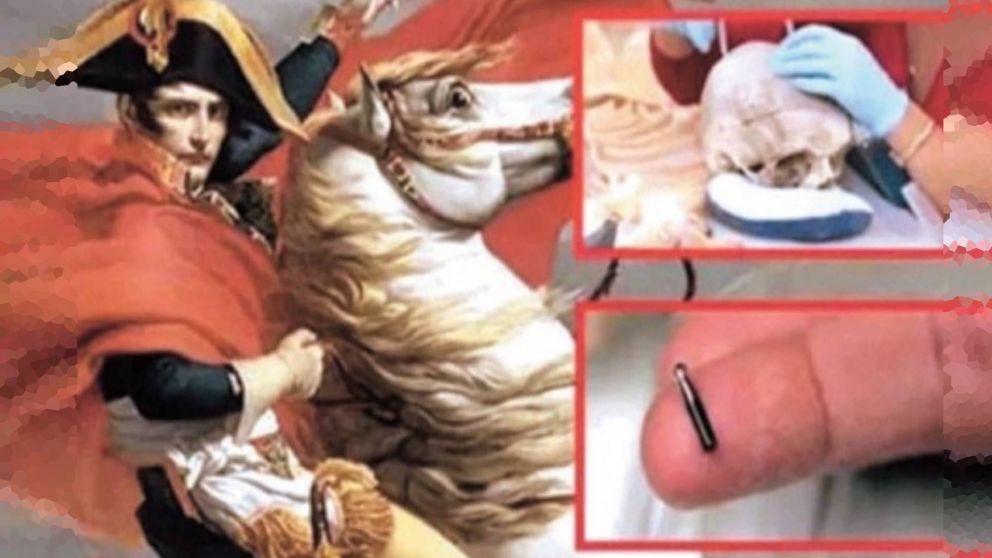 El enigma del chip en el cadáver de Napoléon Bonaparte