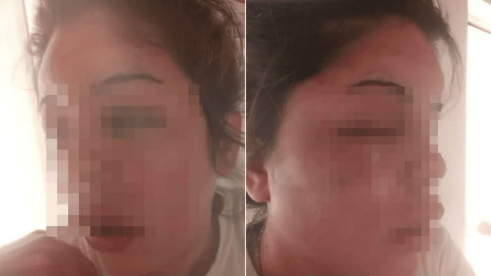 La mujer terminó en el hospital por las heridas.