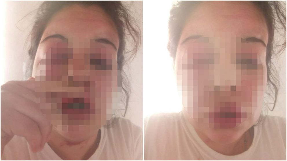 La mujer agredida pidió ayuda, la rescataron y terminó en el hospital.