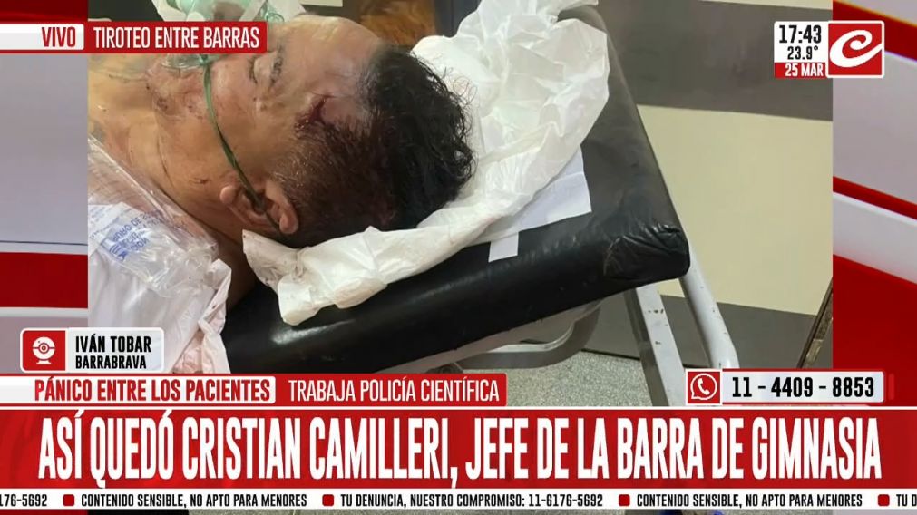 Camilleri tiene varias heridas.
