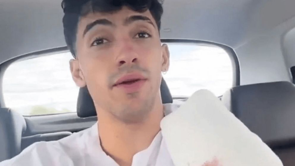 El influencer Gero Arias sufrió la amputación de dos dedos de su mano tras caer desde un acantilado (Imagen captura vídeo).