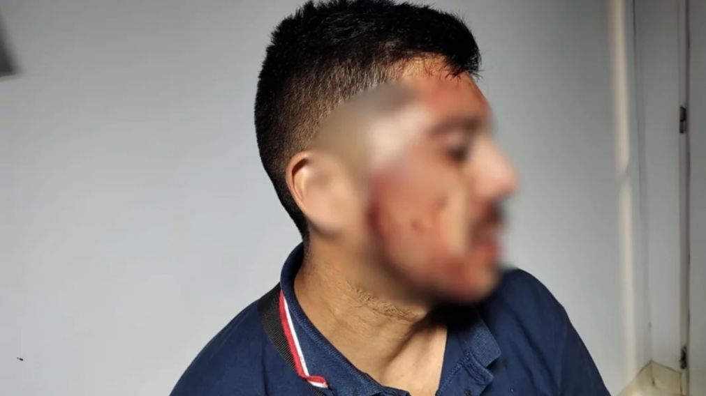 Un chofer fue tajeado en la cara luego de que le intentaran robar.