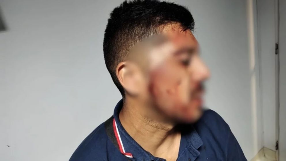 Un chofer fue tajeado en la cara luego de que le intentaran robar.