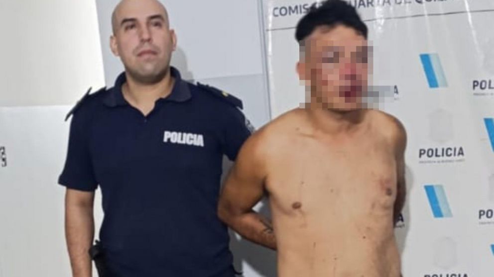 El ladrón sufrió lesiones en el rostro por la brutal golpiza.