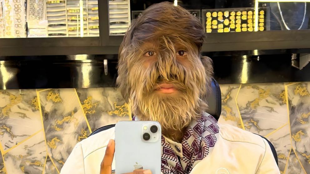 Lalit Patidar tiene 18 años y es de la India.