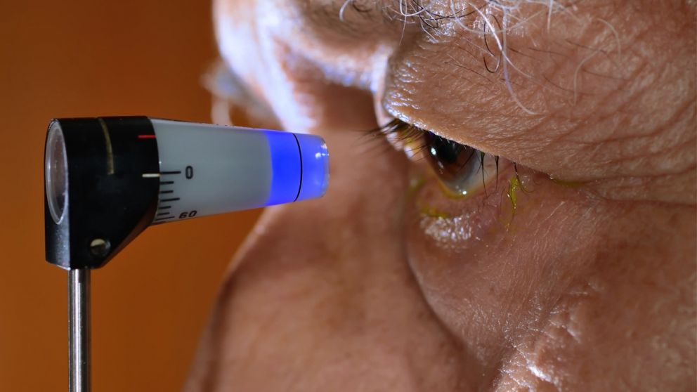 Si es no tratado a tiempo, el glaucoma puede terminar en ceguera (Imagen ilustrativa).