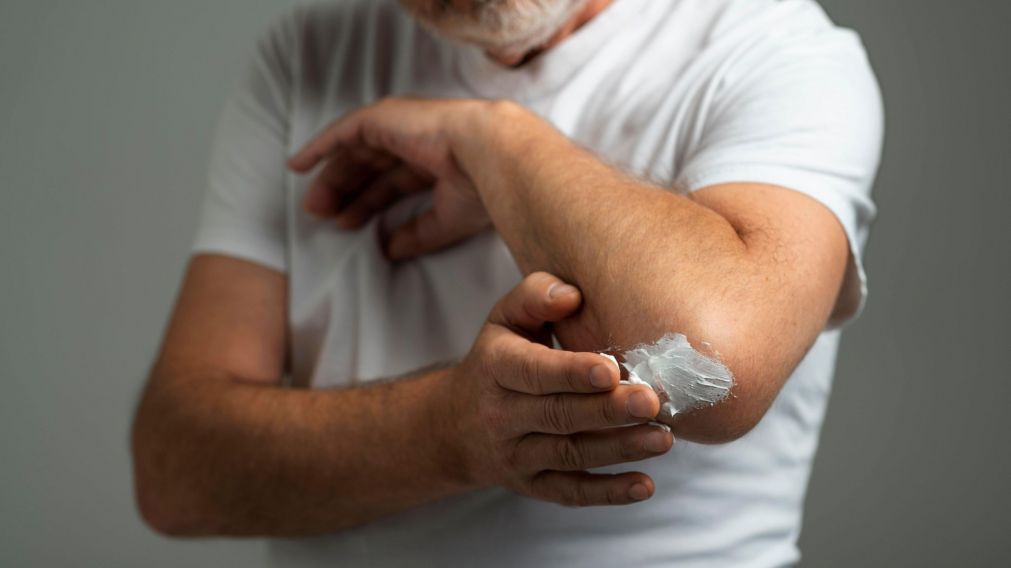 ANMAT prohibió cremas para el resfrío, quemaduras y dolores musculares (Freepik).