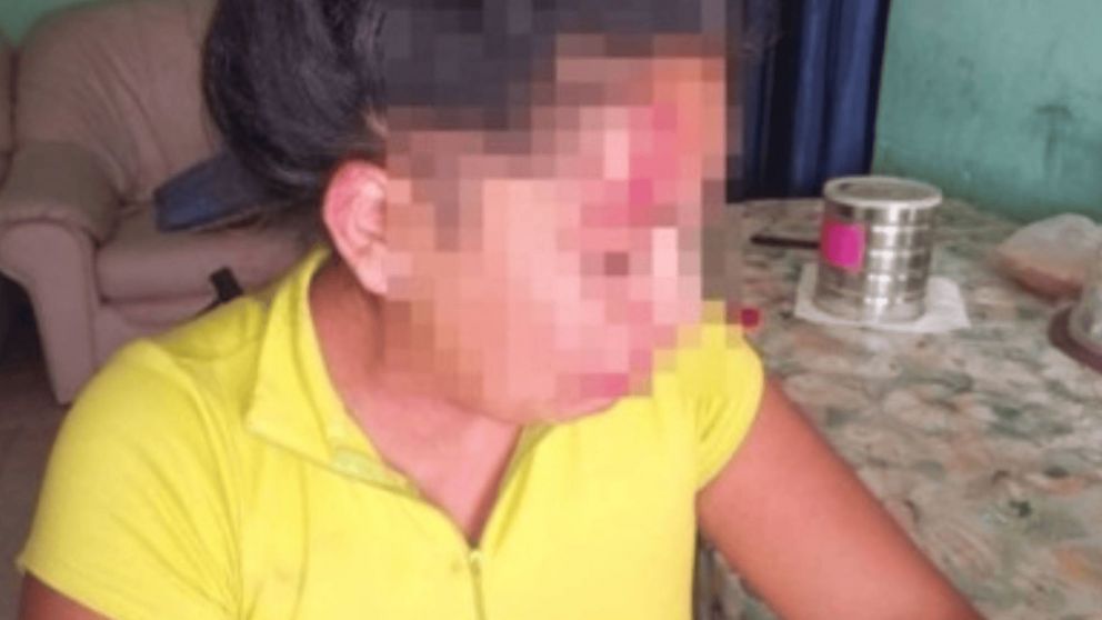 En redes, una mujer denunció que su ex la desfiguró a golpes en frente al hijo de 3 años: "Si me pasa algo..."