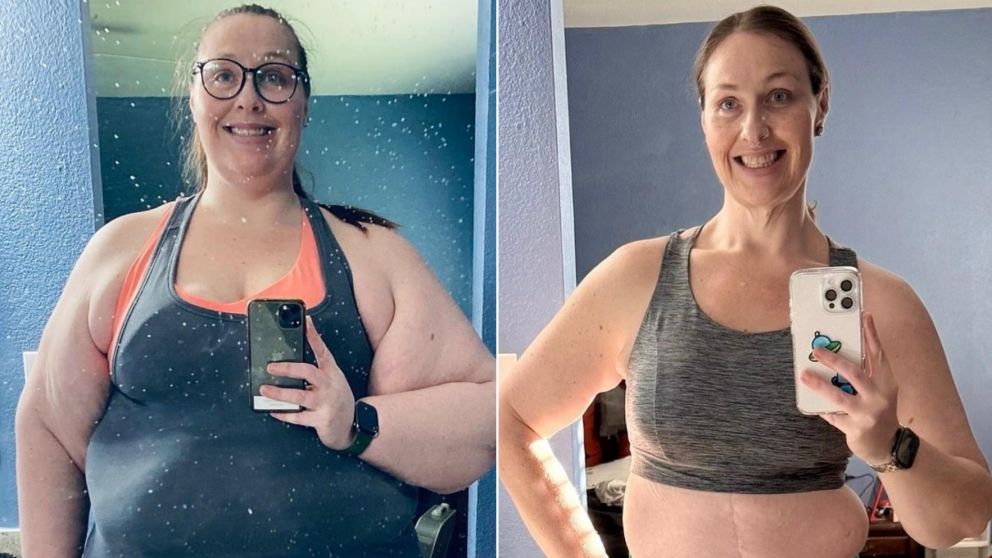 Tori Phillips tenía obesidad mórbida, bajó 100 kilos y mostró su impactante cambio físico.