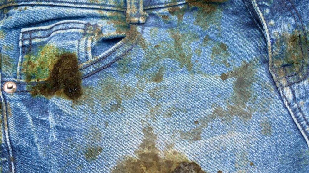 Hay varios trucos caseros para quitar el óxido de la ropa (Imagen ilustrativa).