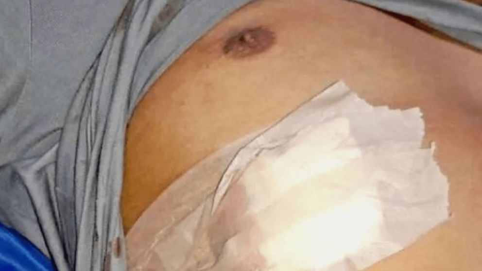 La víctima se encuentra fuera de peligro (Gentileza Nuevo Diario Web).