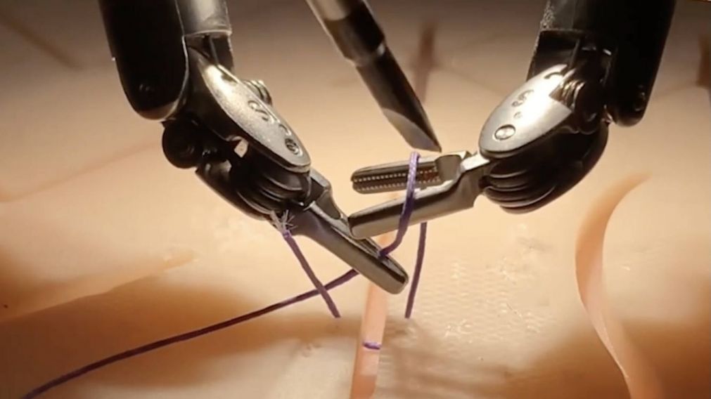 Los robots fueron entrenados con miles de horas de video de cirugías (X).
