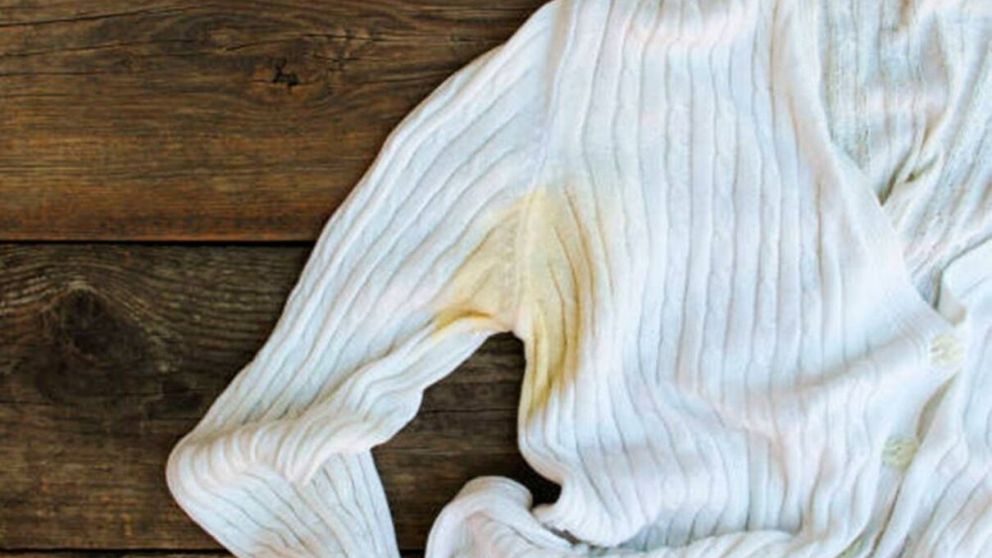 Simples trucos pueden quitar las manchas amarillas de la ropa (Imagen ilustrativa).