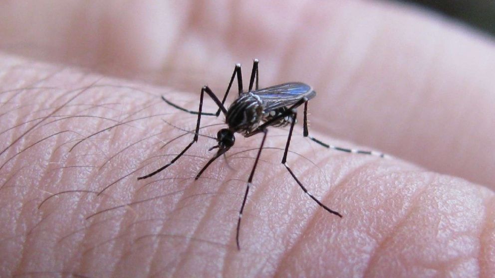 El paciente tiene 32 años.