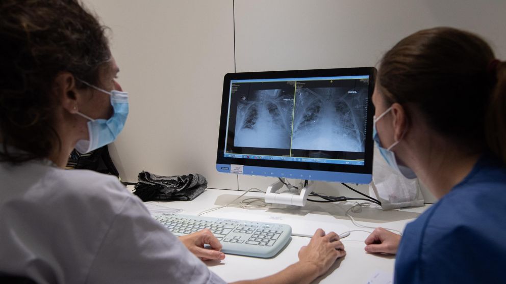 La neumonía tiene que ser controlada para evitar males mayores (Imagen ilustrativa).