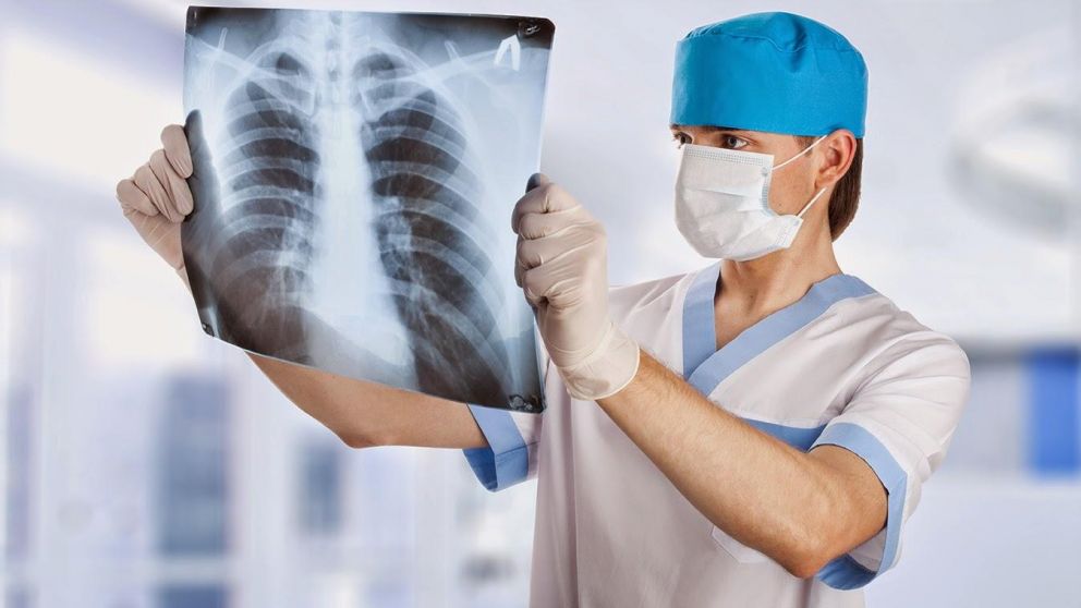 La radiología le permite al médico saber sobre la gravedad de un paciente (Imagen ilustrativa).