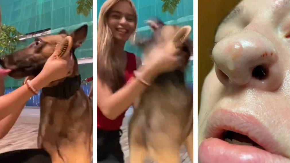 Así un perro le comió la nariz: tuvieron injertarle piel, ahora le crecen pelos y compartió su tragedia en redes sociales