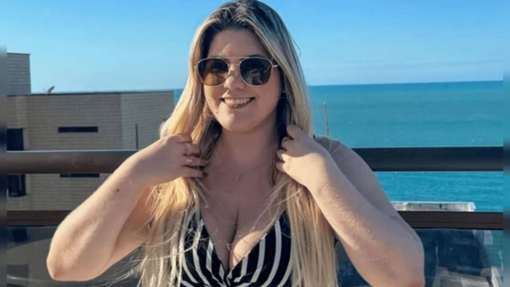 Una joven empresaria se sometió a seis cirugías estéticas en una operación maratónica de ocho horas y murió (Imagen redes sociales).