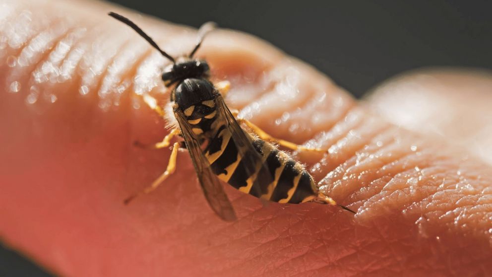 La joven de 16 a�os muri� por una picadura de avispa. (Imagen ilustrativa)