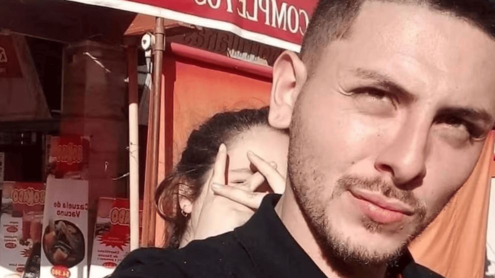 Viruela del mono: falleció el joven cordobés que contrajo la enfermedad en México