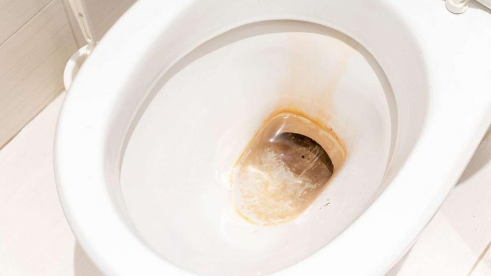 Truco para eliminar el sarro y la "mancha amarilla" del inodoro con solo dos ingredientes.