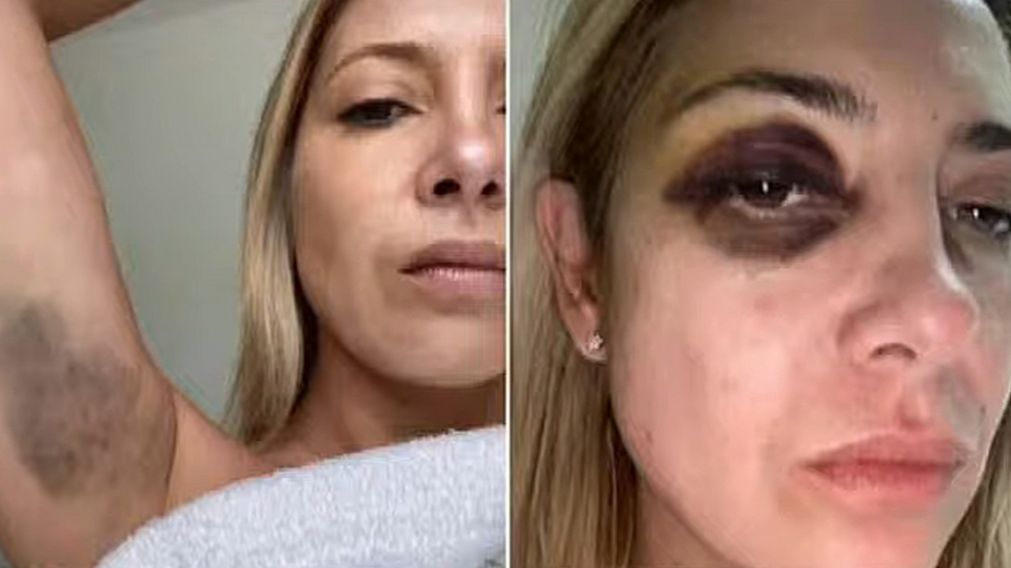 Las fotos y la denuncia de Fabiola Yañez en el expediente contra Alberto Fernández.