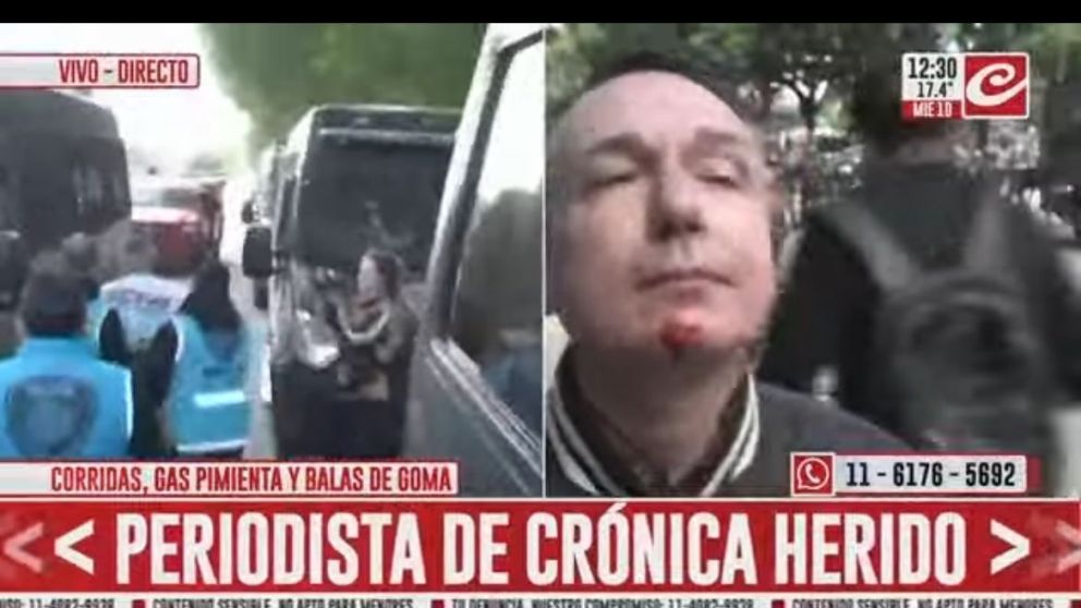Durante el operativo, el periodista Diego Ricciardi de Crónica HD, recibió un balazo de goma en la cara.