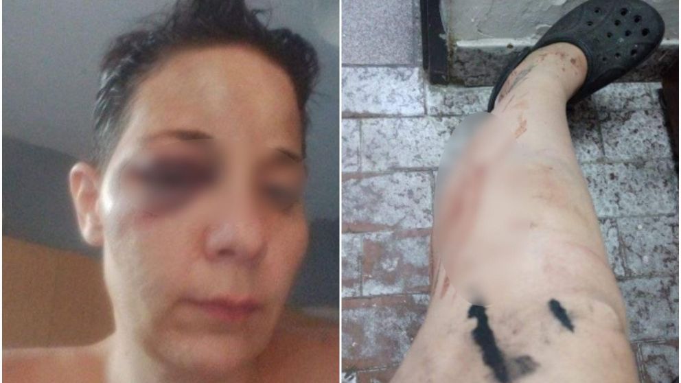 Los narcos atacaron a una mujer que denunció la venta de drogas en San Martín.