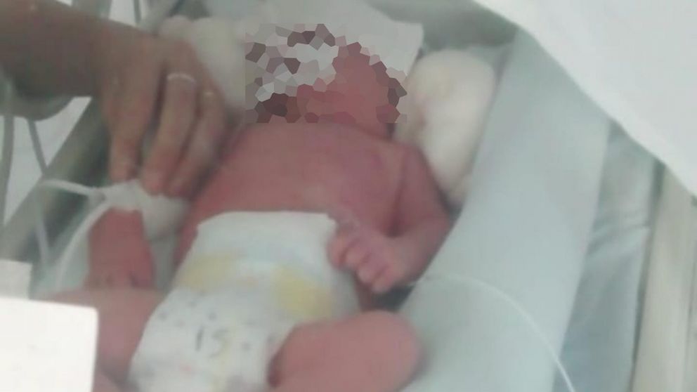 El bebé murió tras agonizar pocos días después de nacer.