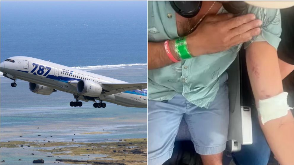 Un avión australiano con destino a Chile se desplomó y dejó a doce pasajeros hospitalizados.