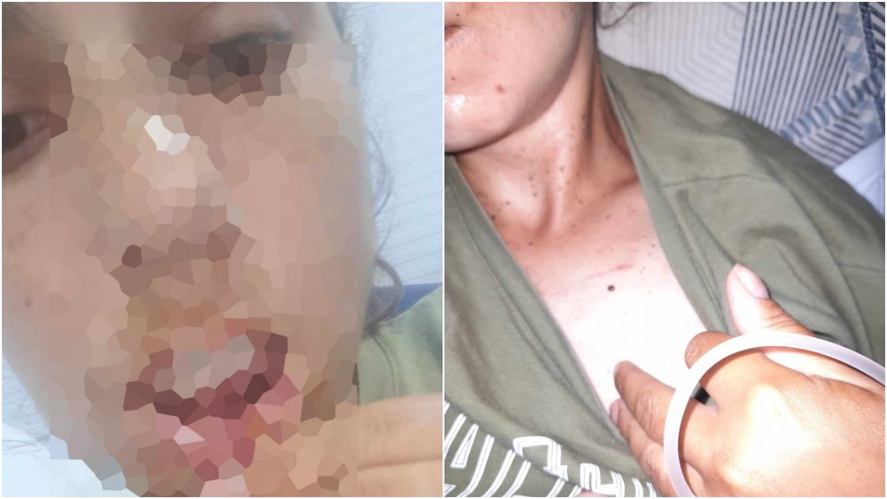 Las damnificadas escracharon al agresor durante la última golpiza.