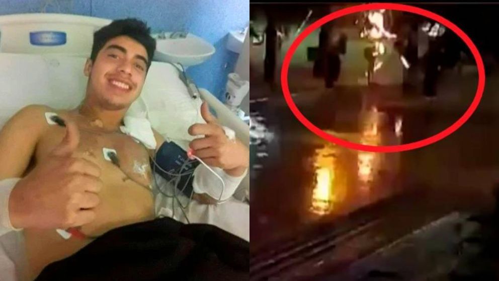 Habló el pibe al que le cayó un rayo mientras paseaba en San Luis.