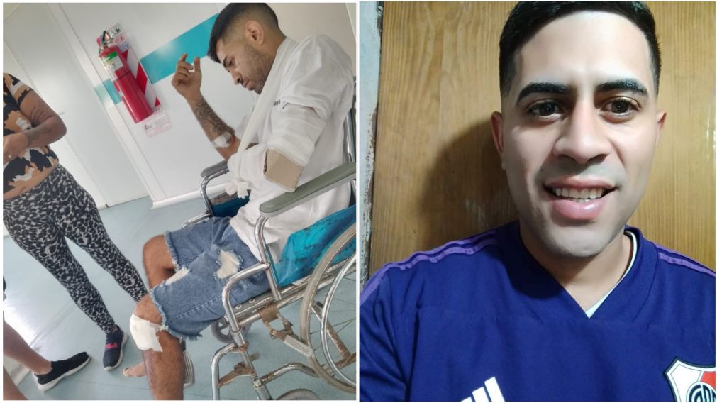 El motociclista afronta un largo proceso de recuperación.