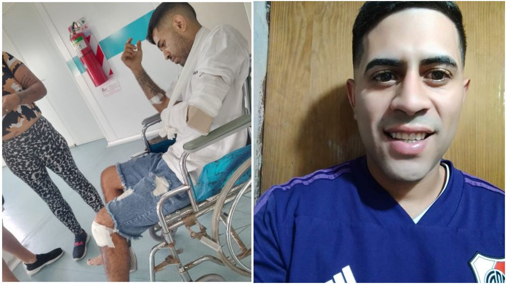 El motociclista afronta un largo proceso de recuperación.