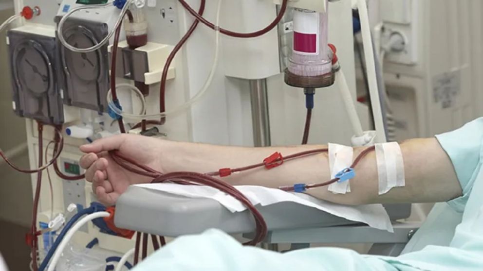 Denuncian que hay 30.000 pacientes en riesgo por falta de insumos para diálisis (Imagen ilustrativa).
