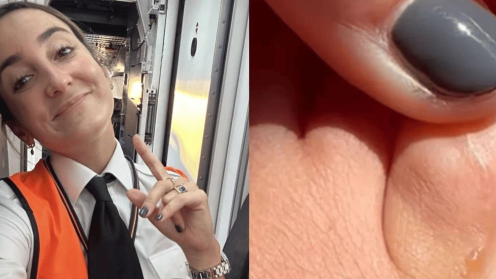 Mostró lo que tiene en un pie y generó conmoción en las redes (Instagram).