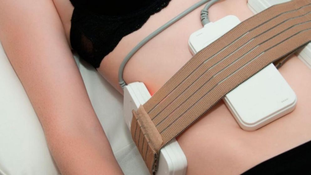 Uno de los productos prohibidos por el ANMAT es un lipolaser (Imagen ilustrativa).