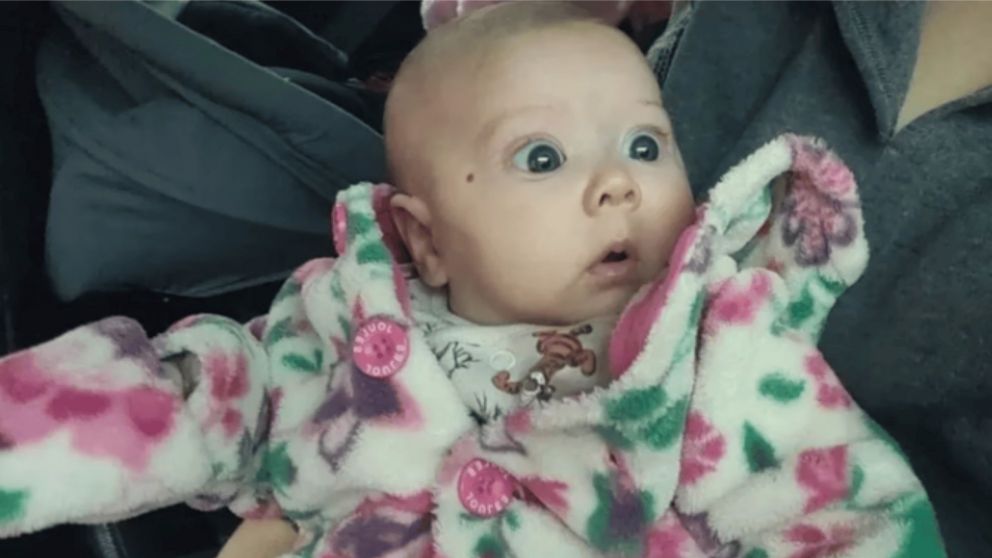 Le ponderaban los ojos azules de su bebes, pero descubrió que se trataba de una terrible enfermedad.