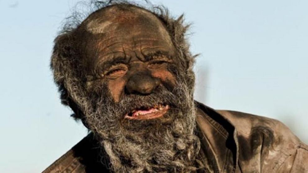 Amou Haji, el hombre "más sucio del mundo", según el diario inglés Daily Mail. Vive en Irán y tiene 80 años.
