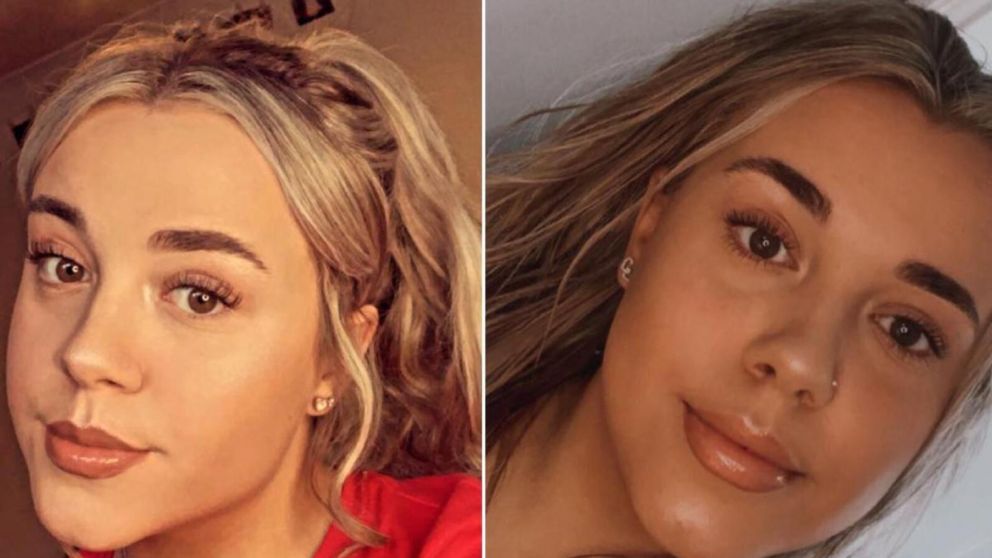 Una se fue de vacaciones sola, regresó con dolor de garganta y murió a los pocos meses (Imagen redes sociales).