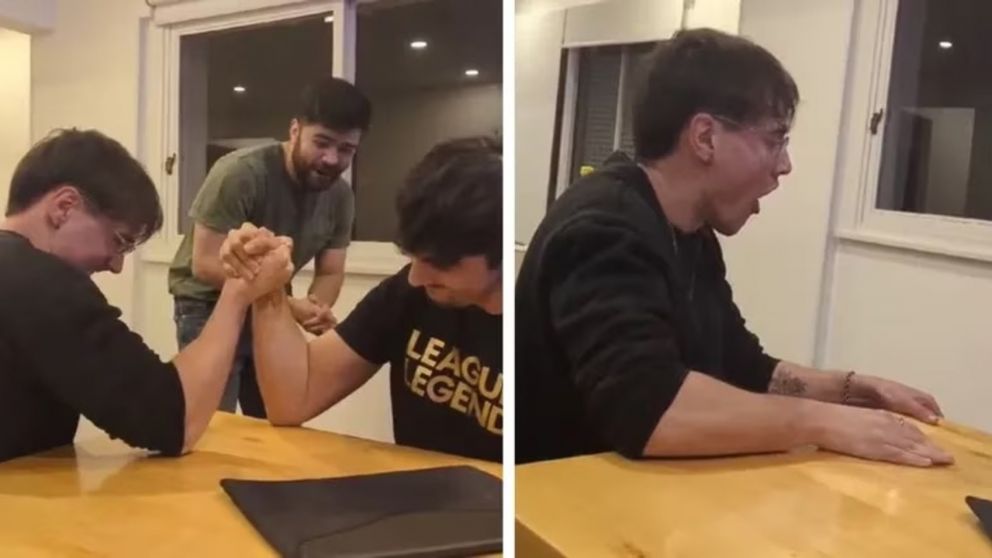 Un joven jugaba una pulseada con un amigo y sufrió una grave lesión que se hizo viral en TikTok (Imagen captura vídeo).