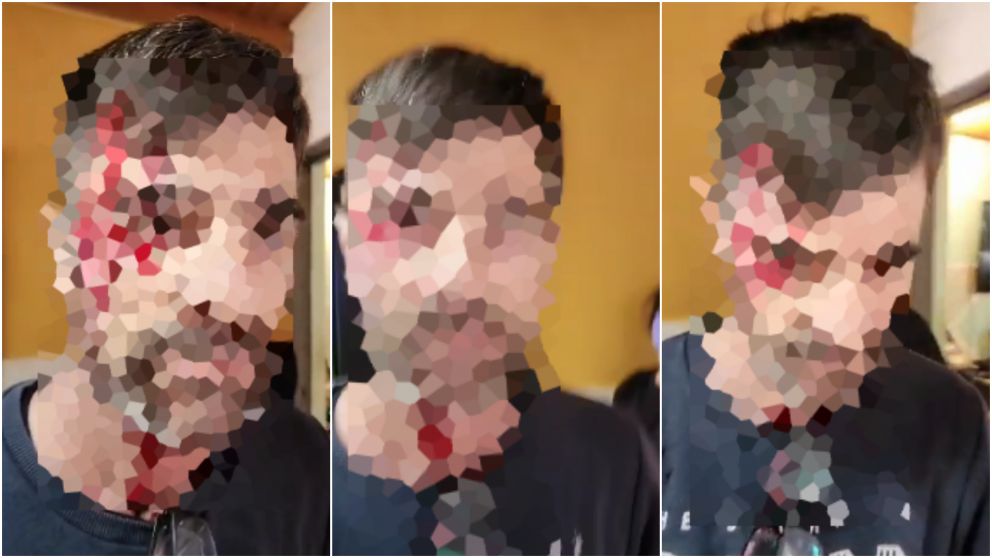 La víctima fue atendida por personal del SAME a raíz de la herida.