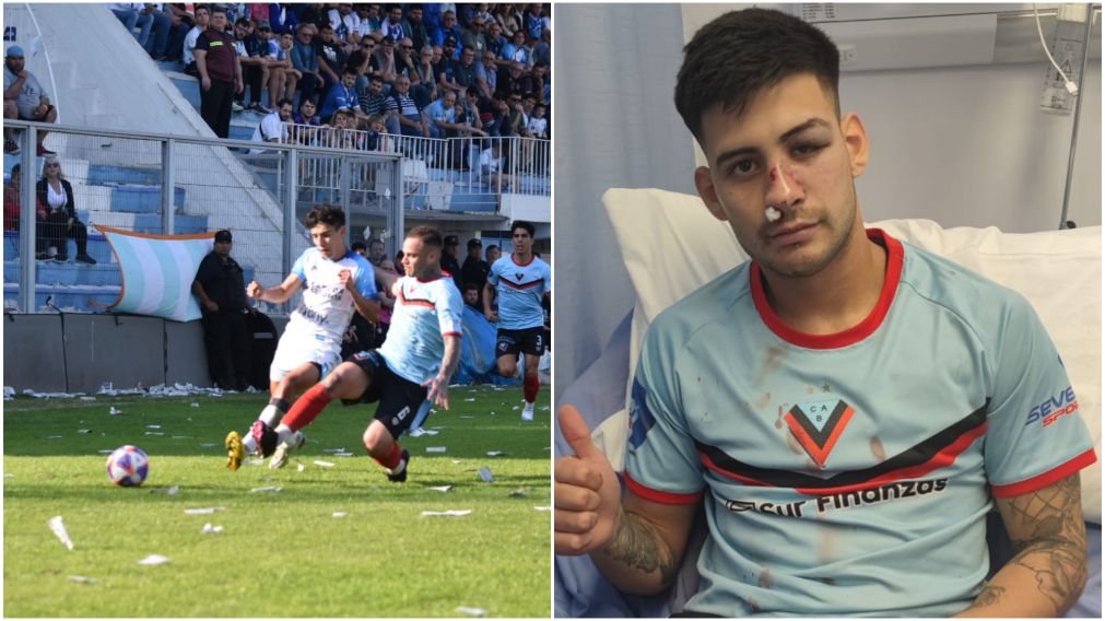 Violenta acción en la Primera Nacional.