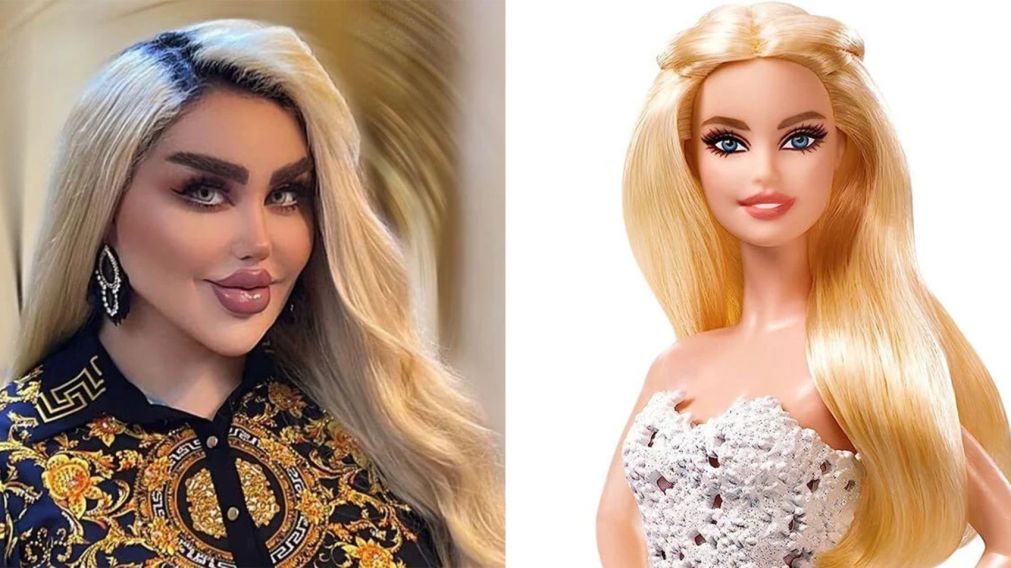 Una influencer gast� una fortuna en 43 cirug�as est�ticas para convertirse en Barbie (Imagen redes sociales).