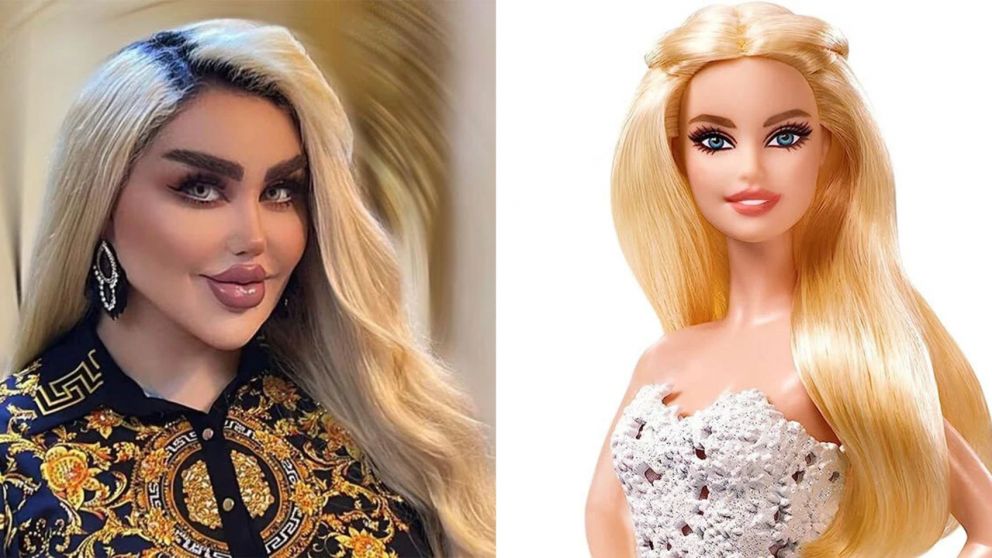Una influencer gastó una fortuna en 43 cirugías estéticas para convertirse en Barbie (Imagen redes sociales).