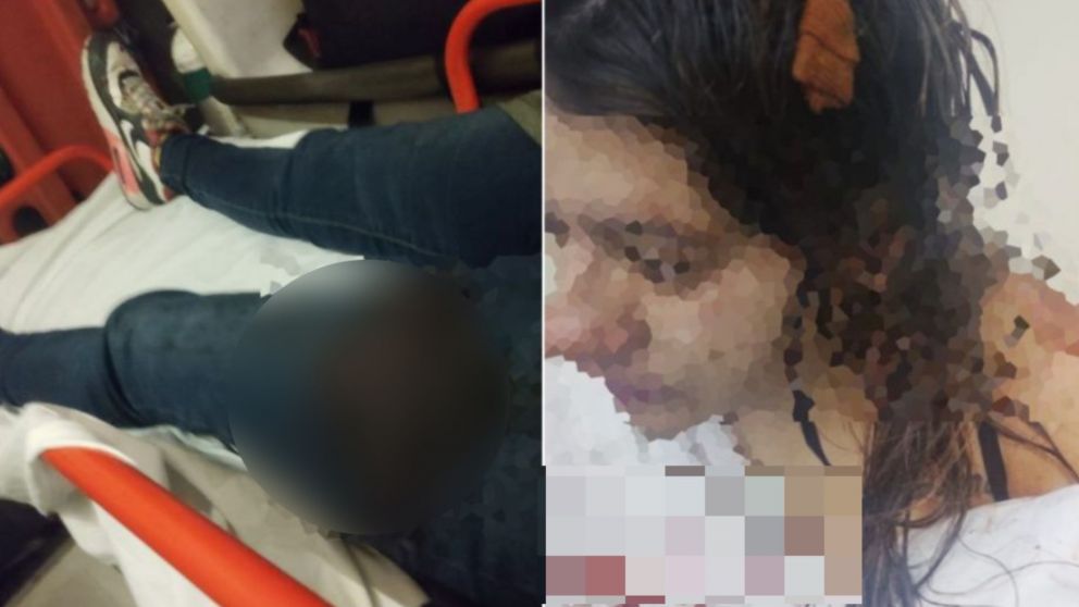 La joven terminó en el hospital, herida y llena de sangre.