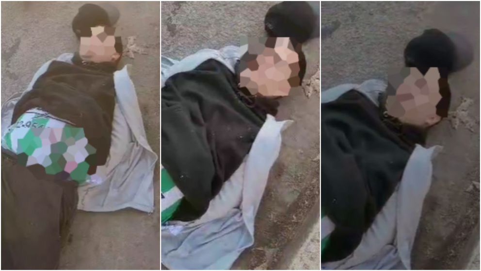 El ladrón fue esposado, mientras expresaba muecas de dolor en su rostro.