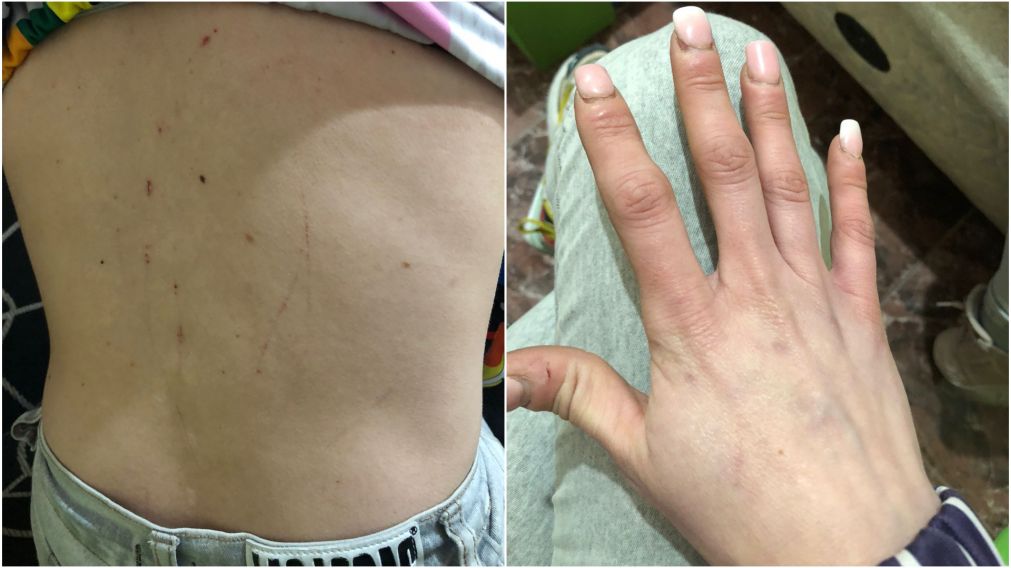 La v�ctima vive atemorizada, por ella y su hijo de 6 a�os.