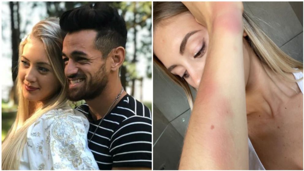 Ludmila, la ex pareja de Lautaro Acosta, lo denunció por segunda vez.