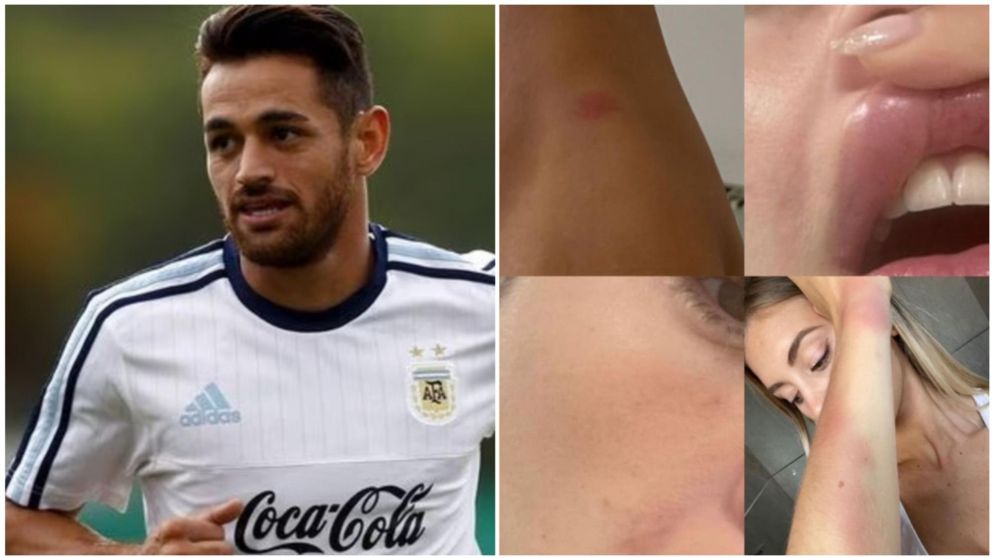 Lautaro Acosta fue denunciado, por segunda vez, por violencia de género.